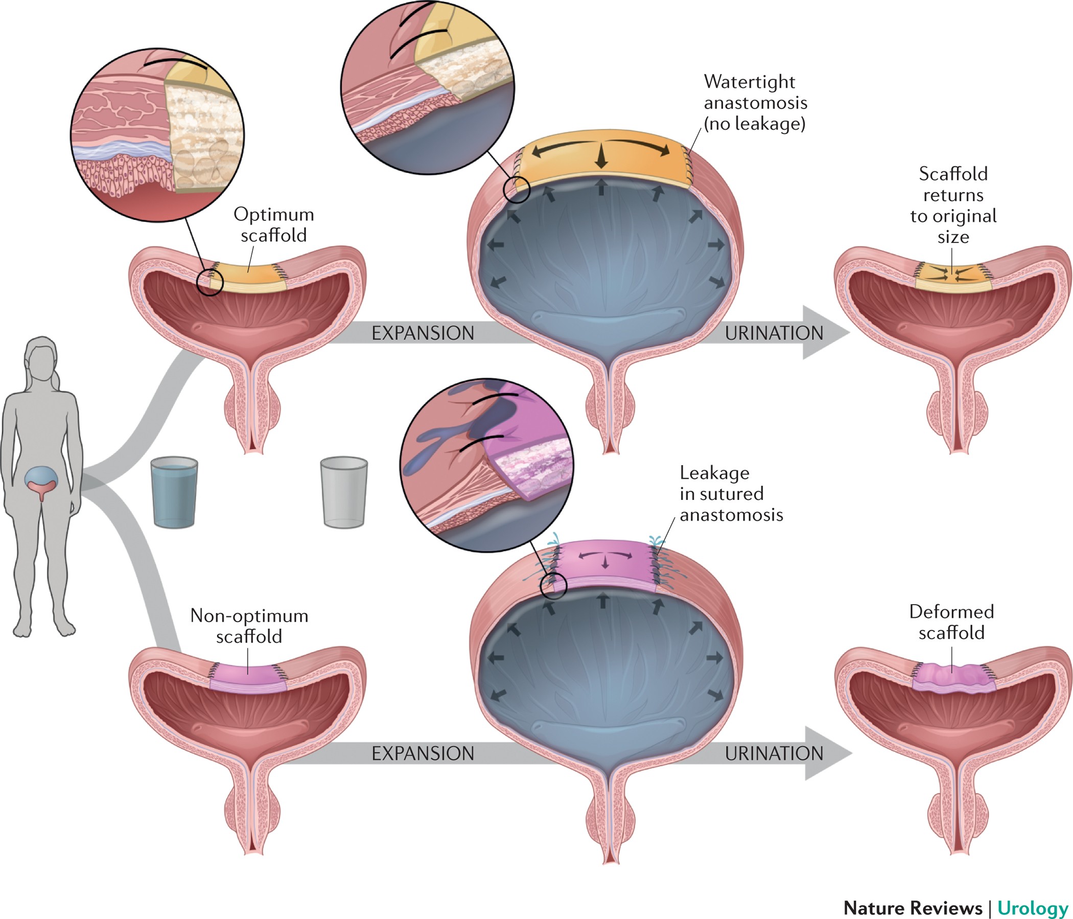  A figure which shows how good knowledge of the mechanical properties of a bladder could transform bladder scaffold design 