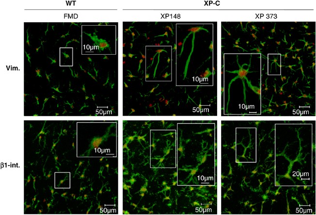 Overexpression of matrix metalloproteinase 1 in dermal fibroblasts from DNA  repair-deficient/cancer-prone xeroderma pigmentosum group C patients |  Oncogene