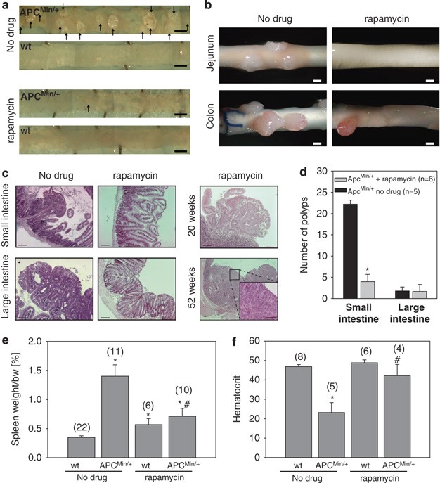 Rapamycin inhibits oncogenic intestinal ion channels and neoplasia in  APCMin/+ mice | Oncogene