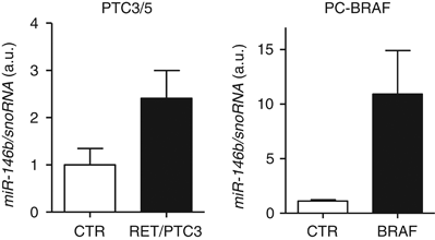 Microrna Mir 146b 5p Regulates Signal Transduction Of Tgf B By Repressing Smad4 In Thyroid Cancer Oncogene