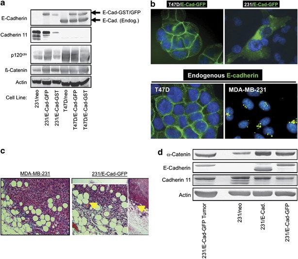 Glucocorticoids And Histone Deacetylase Inhibitors Cooperate To Block The Invasiveness Of Basal Like Breast Cancer Cells Through Novel Mechanisms Oncogene