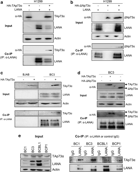 Recruitment of the tumour suppressor protein p73 by Kaposi's Sarcoma  Herpesvirus latent nuclear antigen contributes to the survival of primary  effusion lymphoma cells | Oncogene