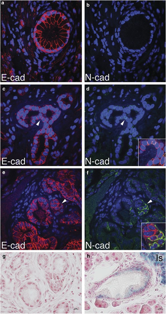 N Cadherin Functions As A Growth Suppressor In A Model Of K Ras Induced Panin Oncogene