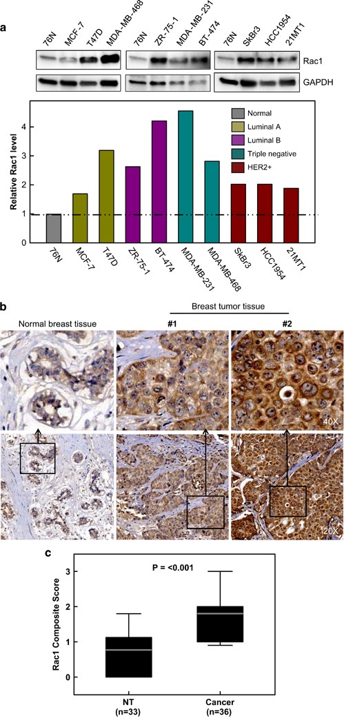RAC1 GTPase promotes the survival of breast cancer cells in response to  hyper-fractionated radiation treatment | Oncogene