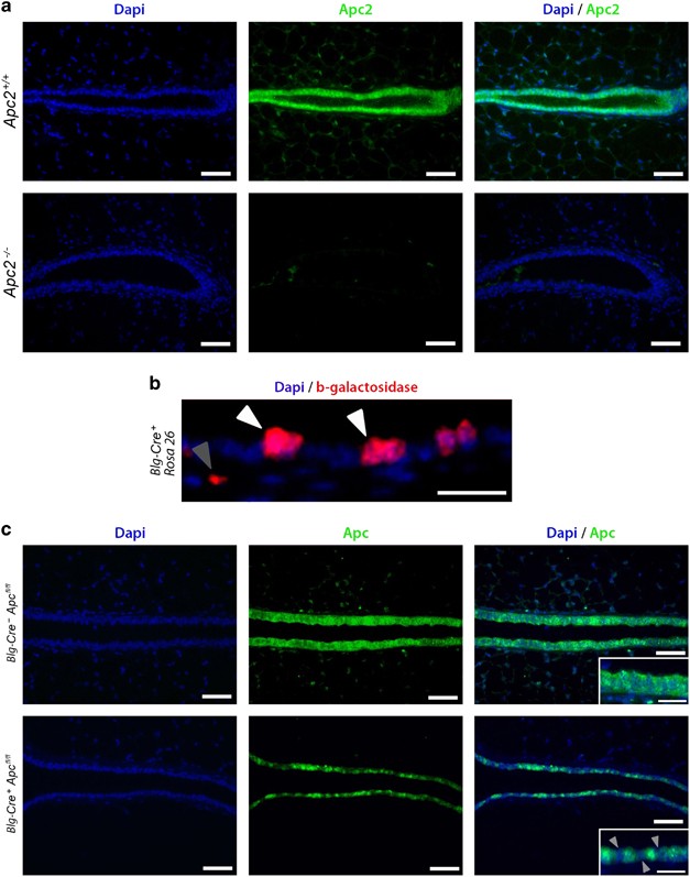 Bcl9 and Pygo synergise downstream of Apc to effect intestinal neoplasia in  FAP mouse models