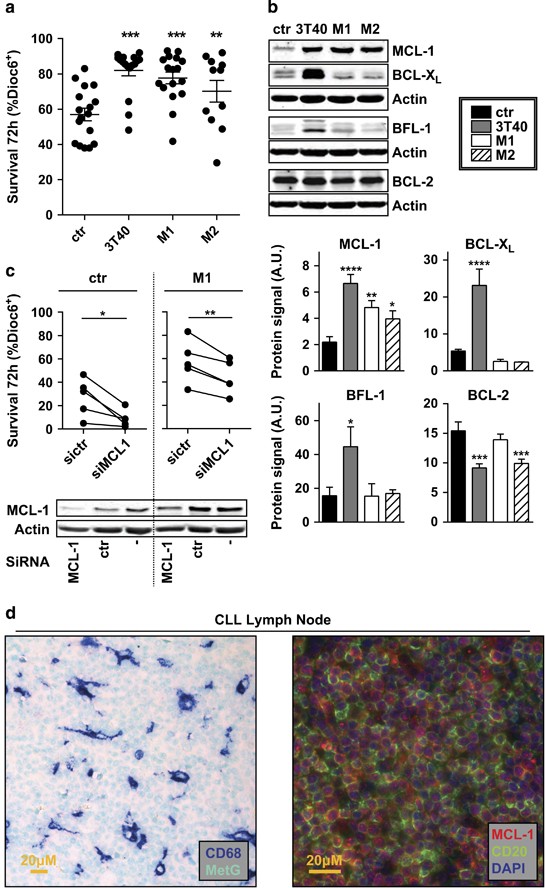 Macrophages confer survival signals via CCR1-dependent translational MCL-1  induction in chronic lymphocytic leukemia | Oncogene