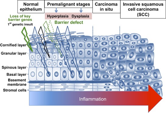 The role of barrier genes in epidermal malignancy | Oncogene
