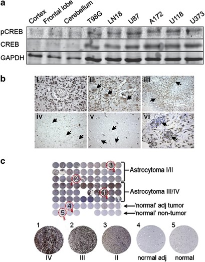 Selective Creb Dependent Cyclin Expression Mediated By The Pi3k And Mapk Pathways Supports Glioma Cell Proliferation Oncogenesis