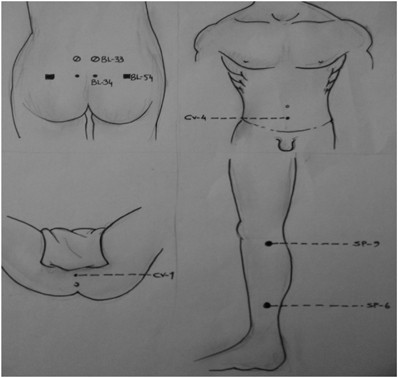 acupuncture pressure points for prostate)