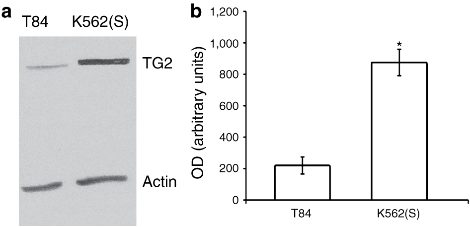 Early tissue transglutaminase–mediated response underlies K562(S)-cell  gliadin-dependent agglutination | Pediatric Research