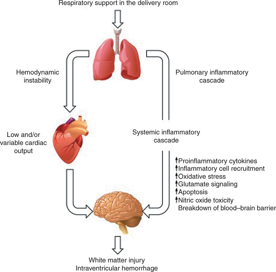 Respiratory support for premature neonates in the delivery room: effects on  cardiovascular function and the development of brain injury