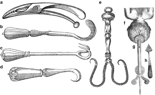 From Apparent Death To Birth Asphyxia A History Of Blame Pediatric Research