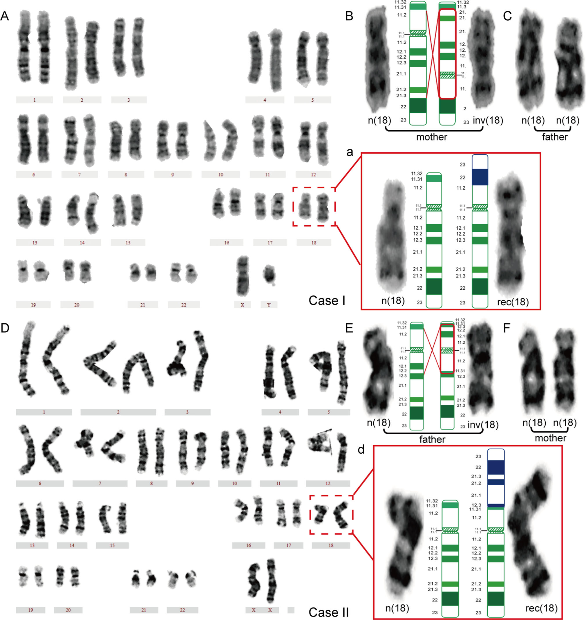 The molecular mechanisms of recombinant chromosome 18 with parental pericentric inversions and a review of the literature Journal of Human Genetics image