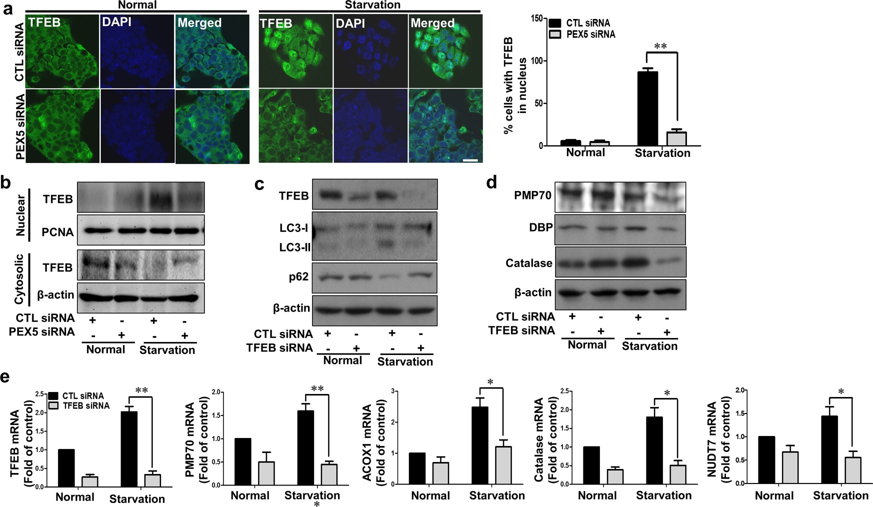 Fig. 3: PEX5 depletion inhibits nuclear translocation of TFEB in response to starvation.