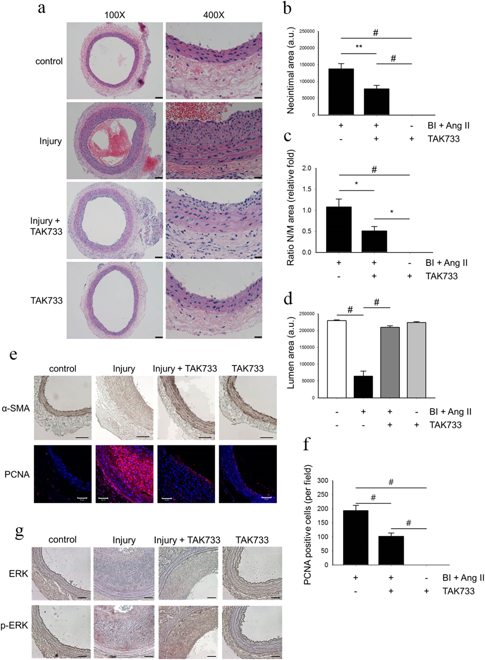 Fig. 4: Effects of TAK-733 on neointimal formation.
