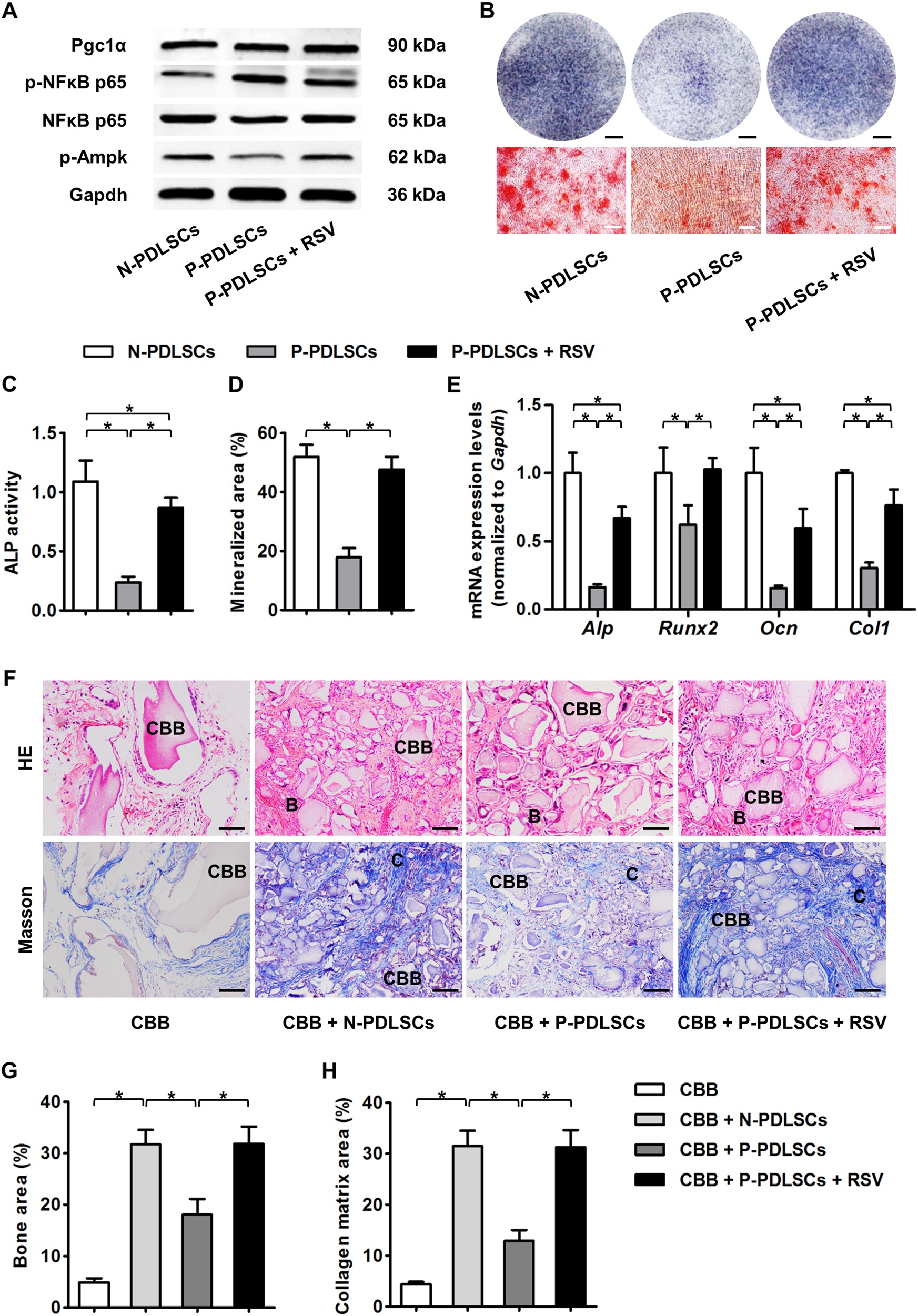 Fig. 3: RSV treatment improved the osteogenic and bone regenerative potential of P-PDLSCs.