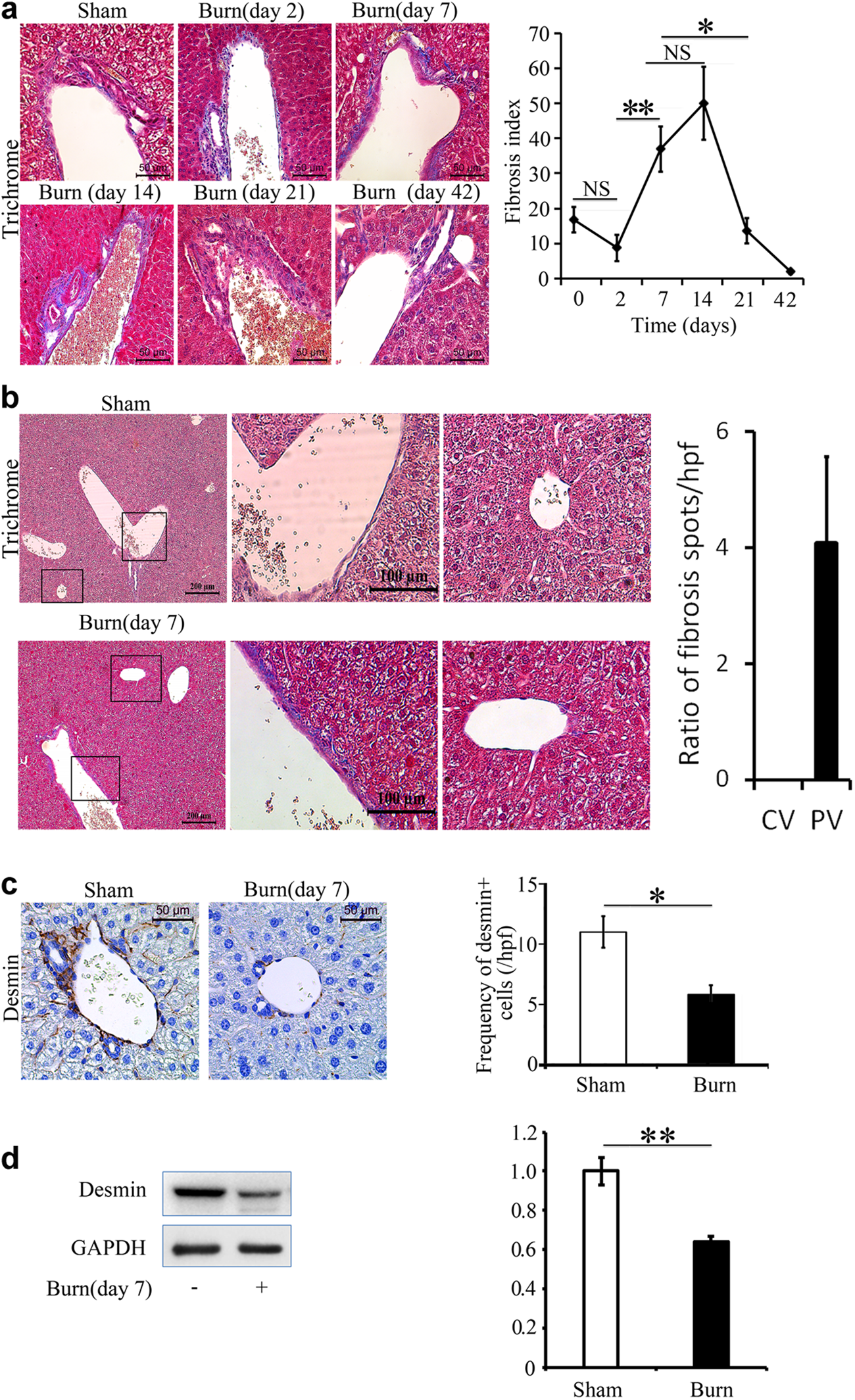 Accumulation of myeloid lineage cells is mapping out liver fibrosis post  injury: a targetable lesion using Ketanserin | Experimental & Molecular  Medicine