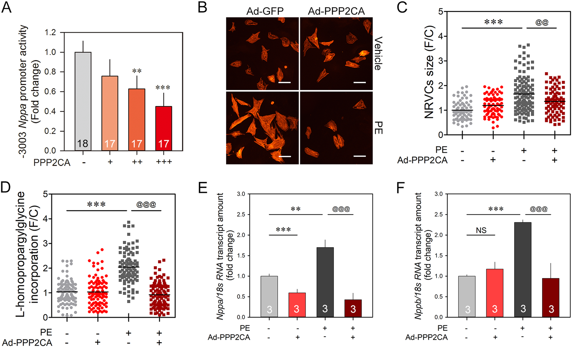 Fig. 4: PPP2CA negatively regulates hypertrophic responses.