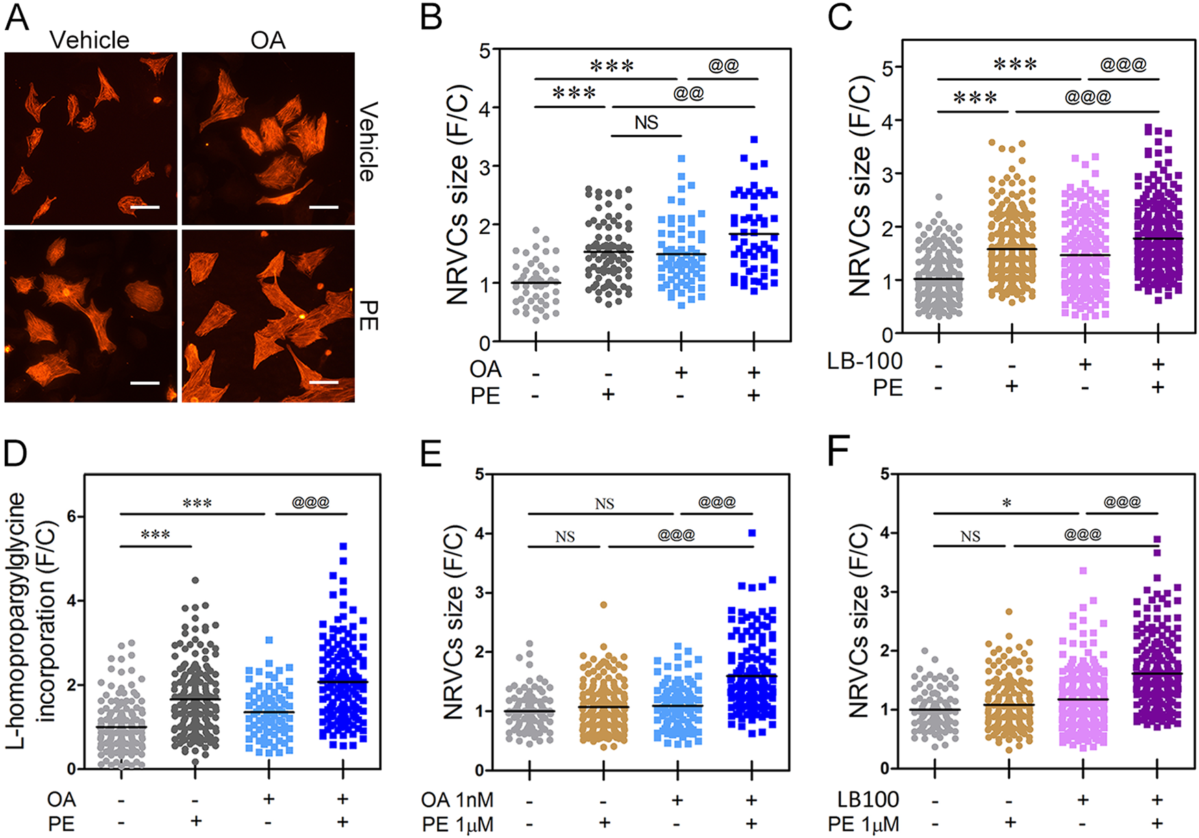 Fig. 5: PP2A inhibitor augments the hypertrophic response.