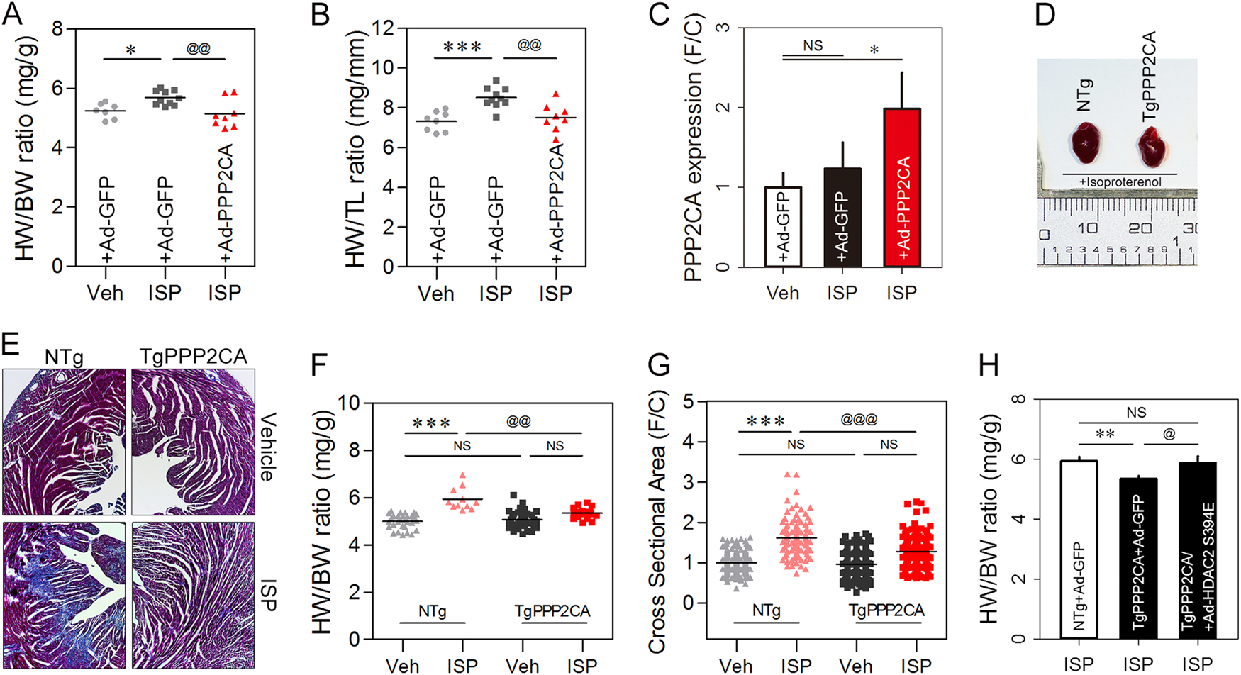 Fig. 7: PPP2CA negatively regulates cardiac hypertrophy through HDAC2 dephosphorylation in the heart.