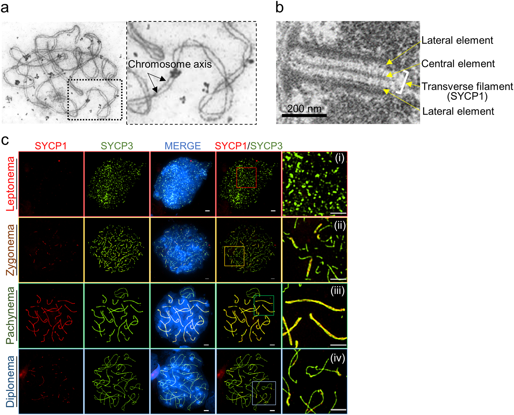 Structured Illumination Microscopy Imaging Reveals Localization Of