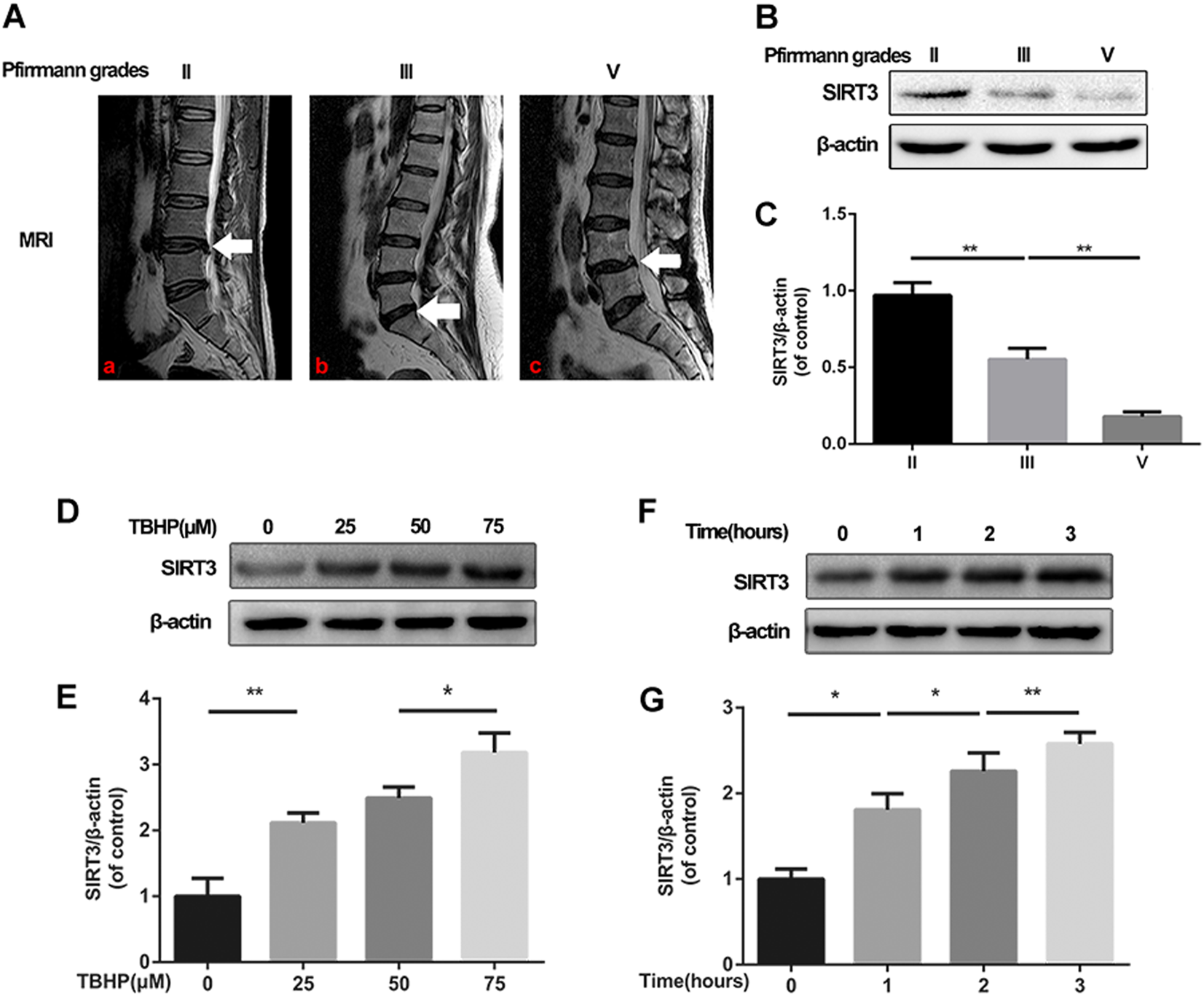 Fig. 1: The expression of SIRT3 decreases in degenerated human disc tissues and increases in TBHP-treated rat NPCs.