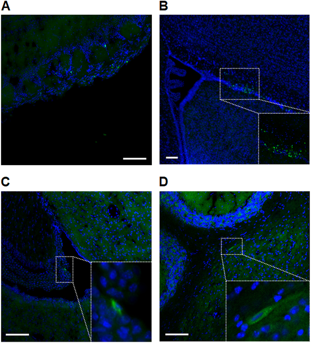 The pathogenesis of Niemann–Pick type C disease: a role for autophagy?, Expert Reviews in Molecular Medicine