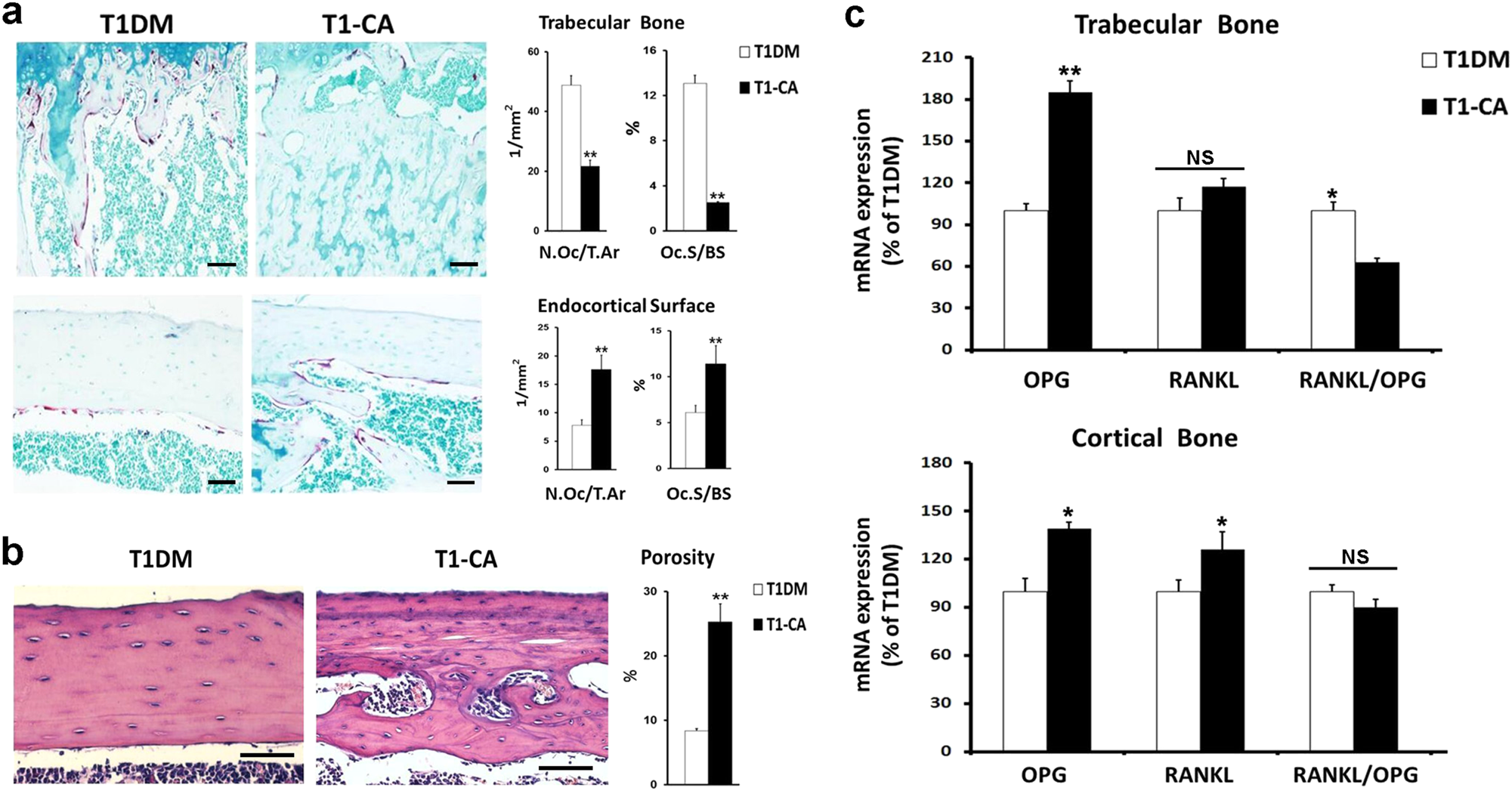 Fig. 4: Osteoblastic activation of β-catenin in T1DM mice increased osteoclasts activities and bone porosity in cortical bone but not in trabecular bone.