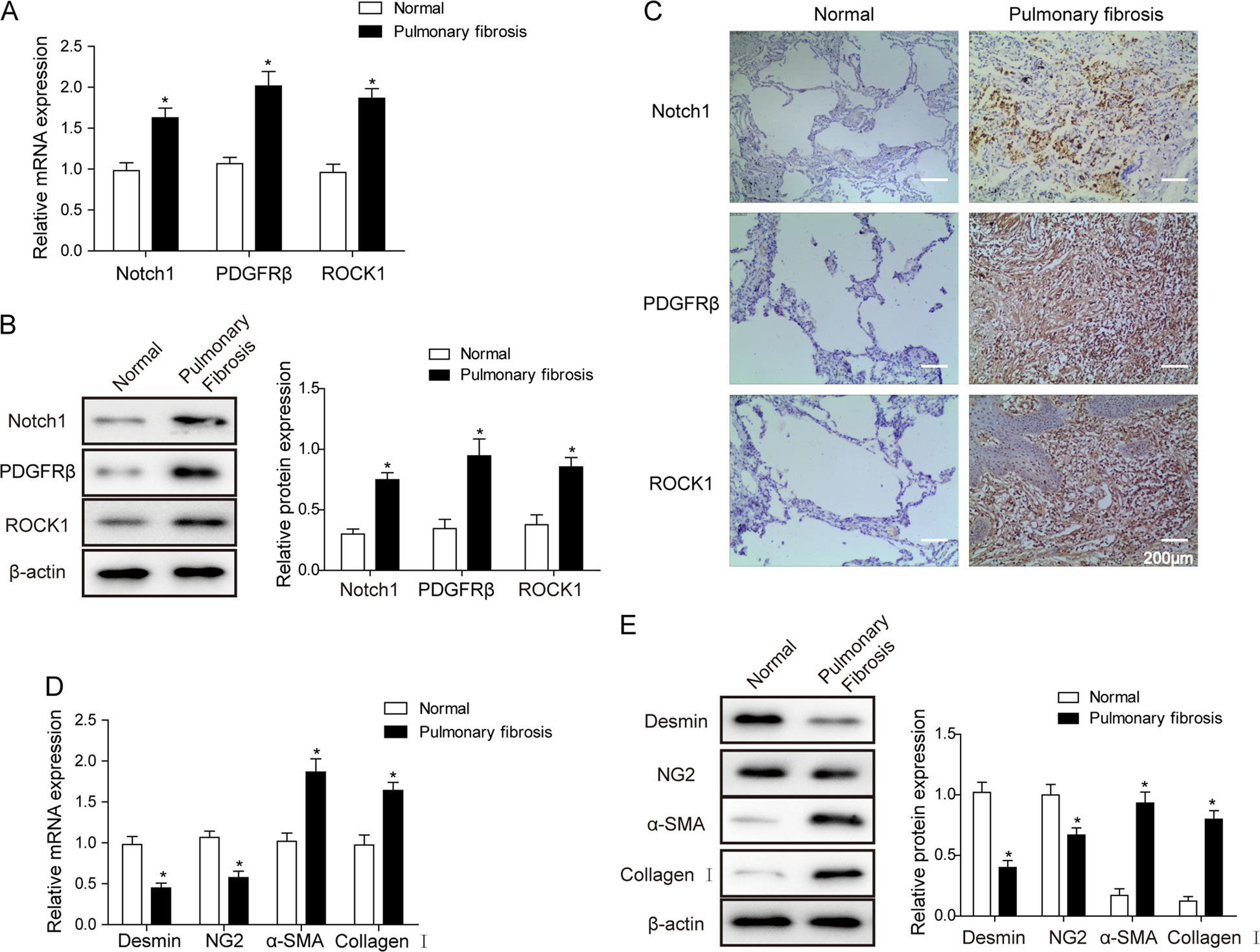 Notch1 signaling enhances collagen expression and fibrosis in
