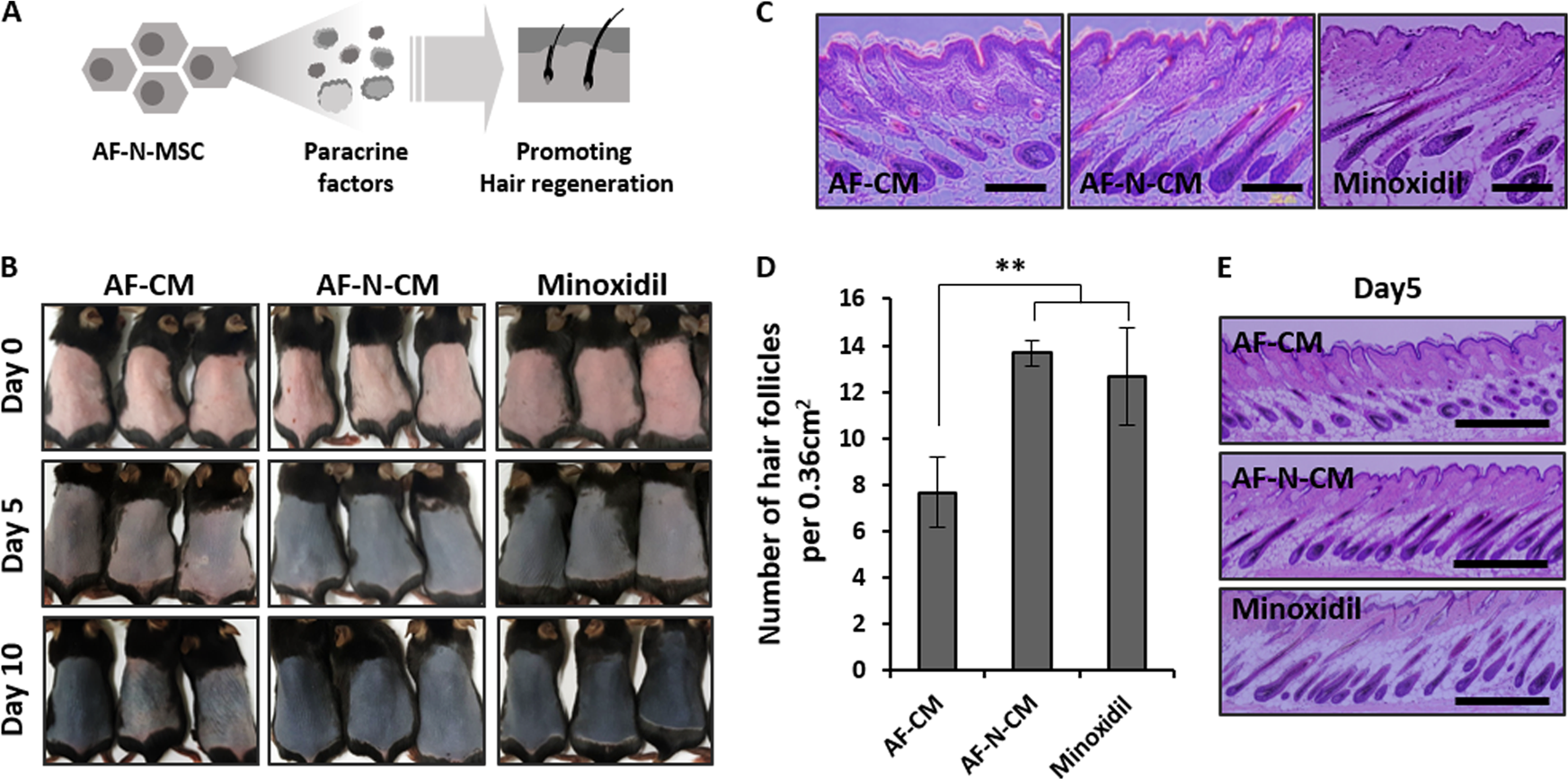 Fig. 5: Increased hair growth in mice by amniotic fluid–derived mesenchymal stem cell overexpressing Nanog (AF-N-MSC)–derived conditioned media (AF-N-CM).