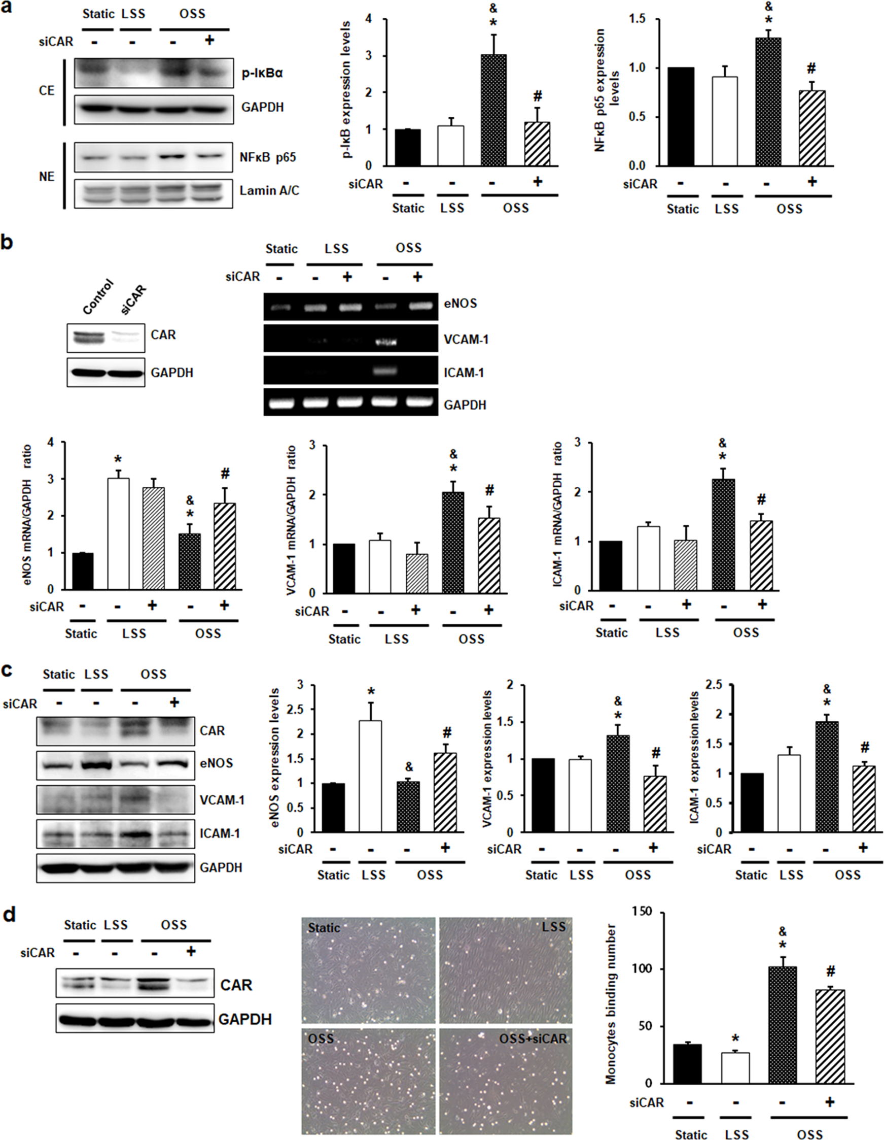 Fig. 3: CAR knockdown inhibits disturbed flow-induced inflammatory responses in endothelial cells.