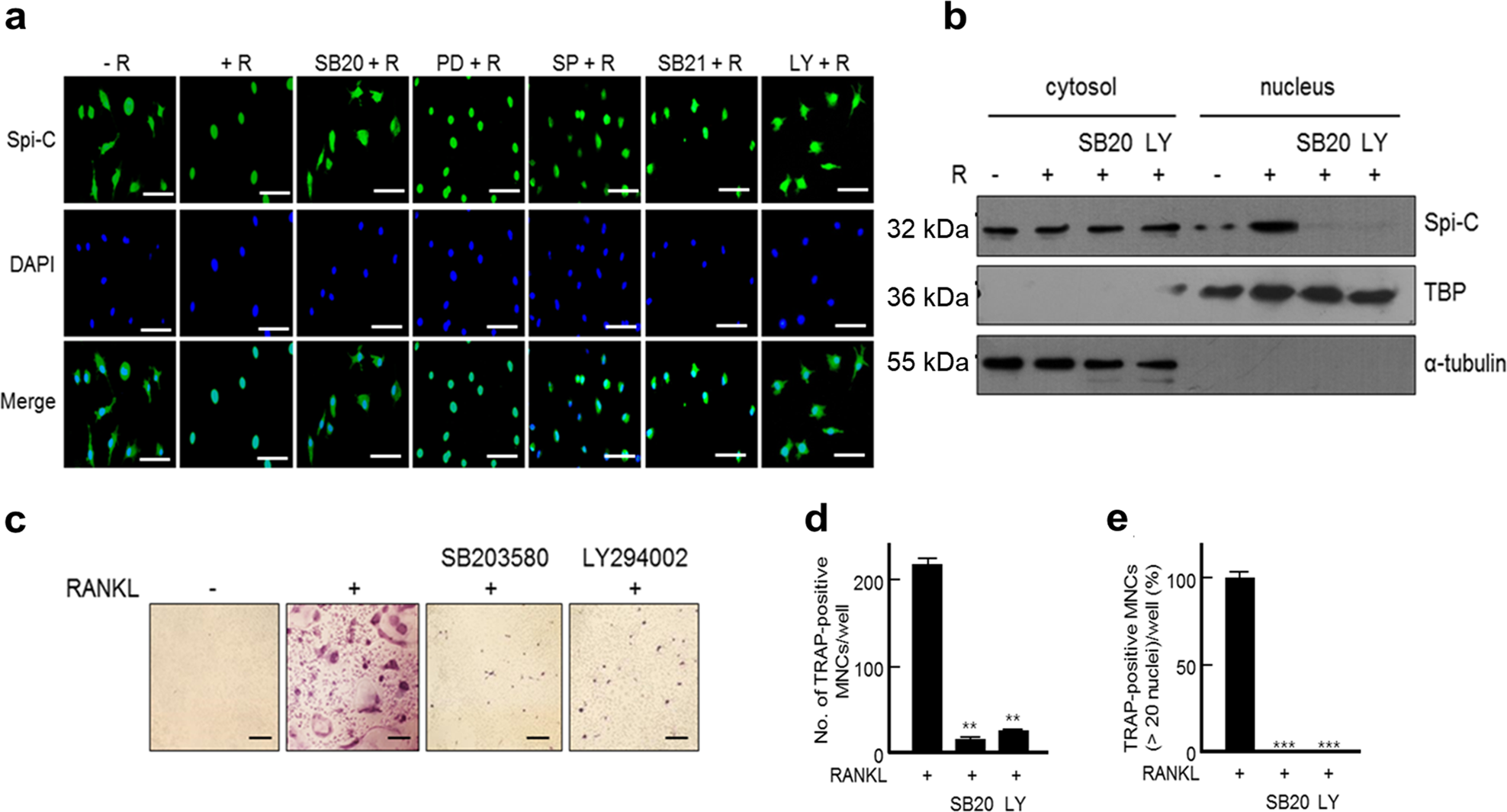 Fig. 5: Nuclear translocation of Spi-C through p38 and PI3K.