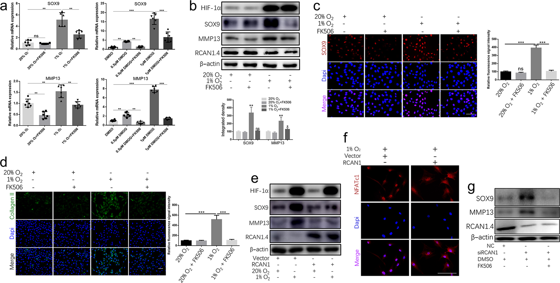 Fig. 3: RCAN1.4 the ECM synthesis and remodeling by regulating the calcineurin/NFAT signaling pathway.
