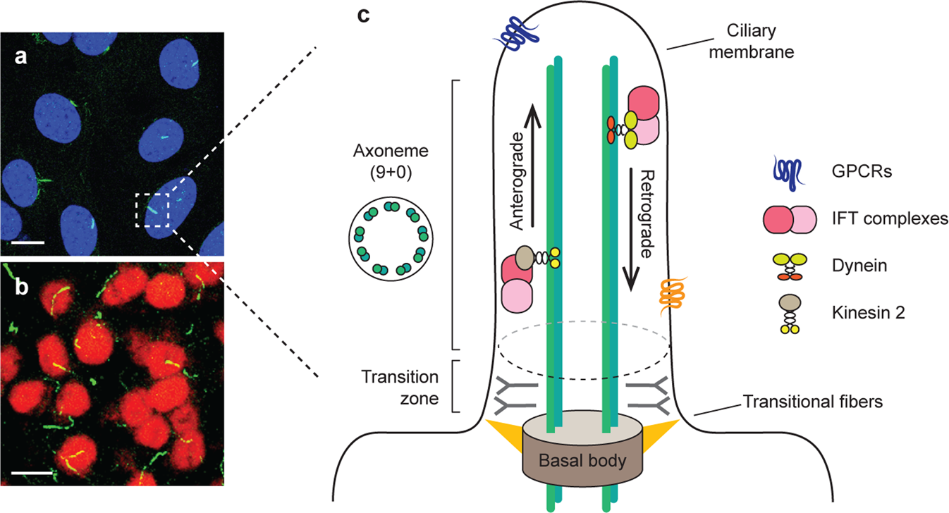Hypothalamic primary cilium: A hub for metabolic homeostasis | Experimental  & Molecular Medicine