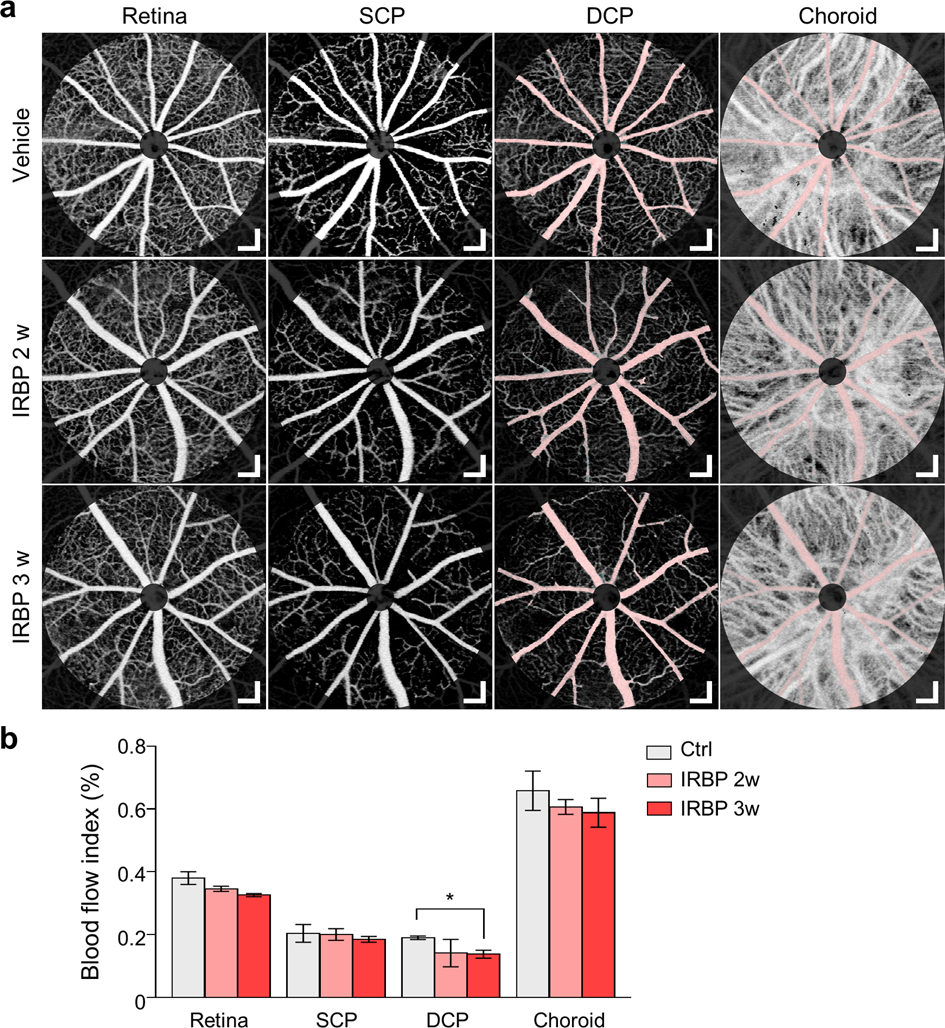 Fig. 6: Optical coherence tomography angiography (OCTA) of the retinas of interphotoreceptor retinoid-binding protein (IRBP)-immunized mice.