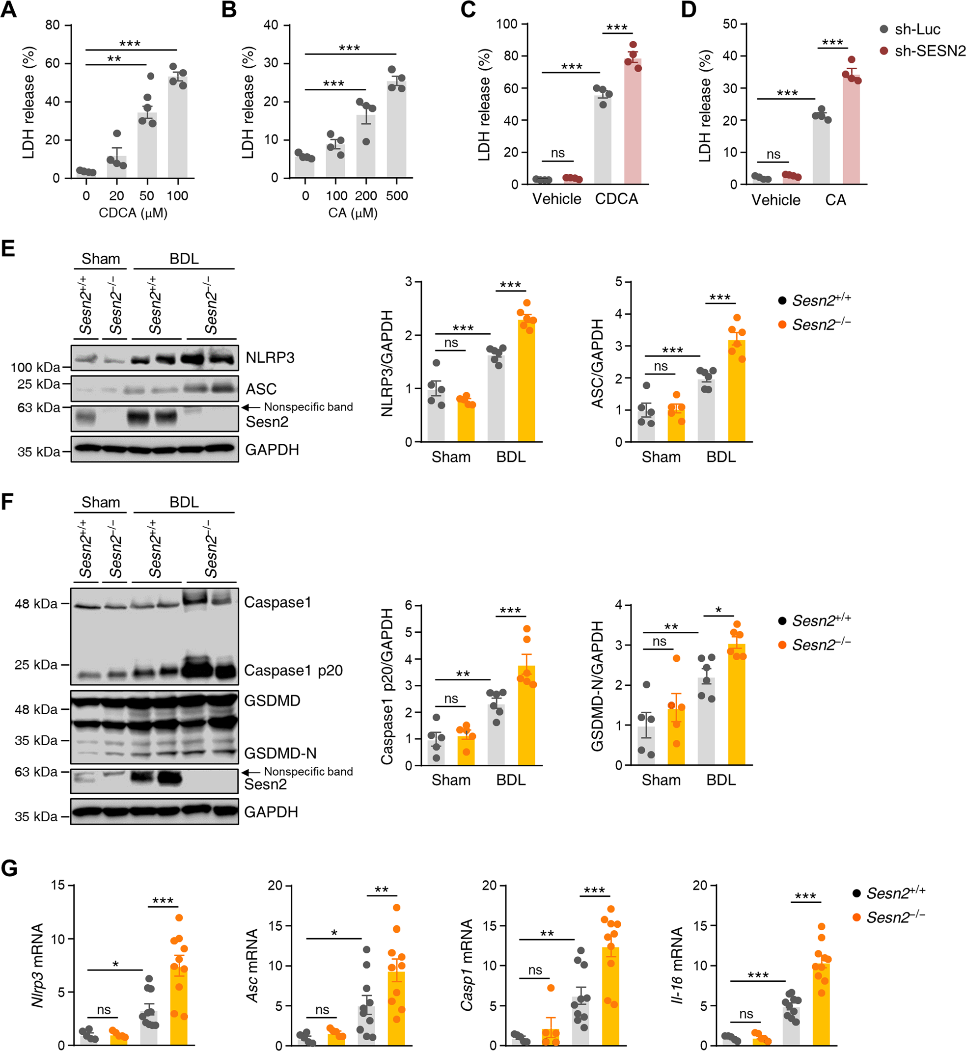 Fig. 7: Sestrin2 deficiency exacerbates NLRP3 inflammasome-mediated pyroptosis in cholestatic livers.