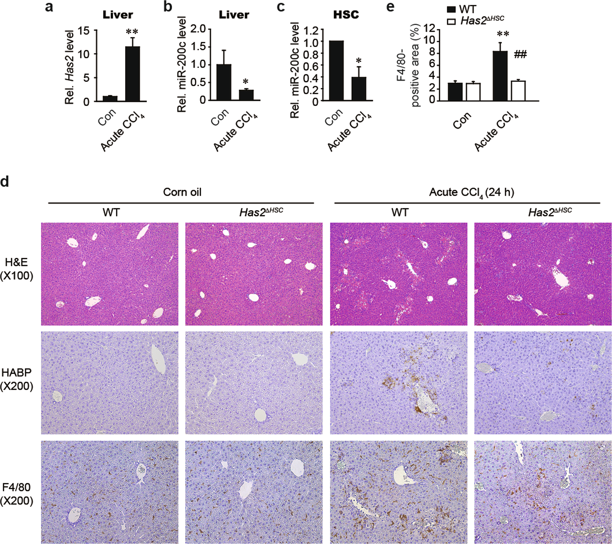 Fig. 6: Has2 deficiency in hepatic stellate cells alleviates CCl4-induced ALI.