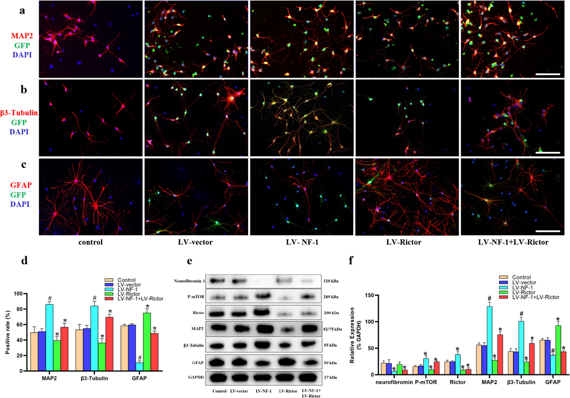 Fig. 2: Knockout of NF-1 promoted neuronal differentiation of neural stem cells (NSCs) by enhancing the mTORC2 pathway in vitro.