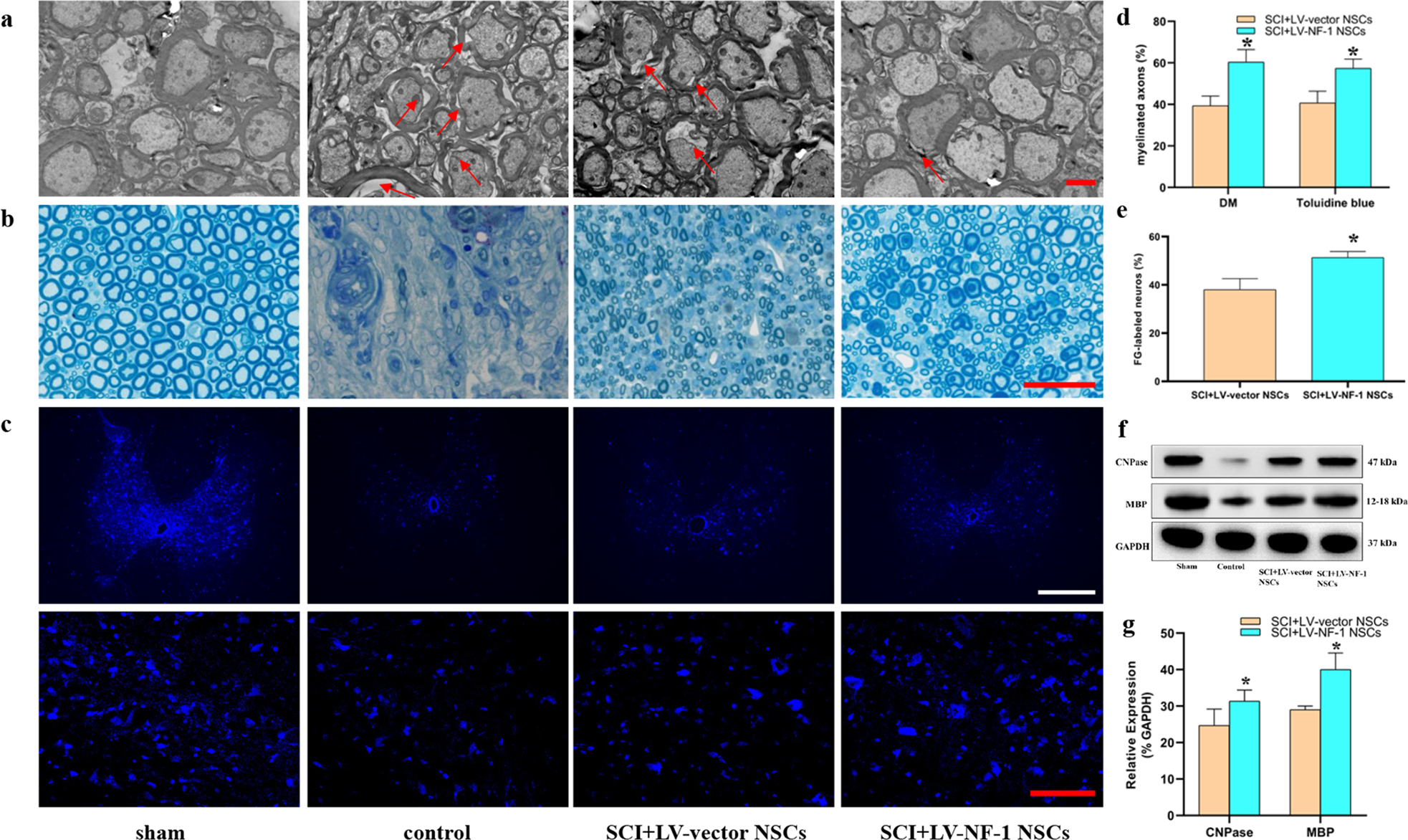 Fig. 6: Transplantation of NF-1 knockout neural stem cells (NSCs) facilitated axonal regeneration.
