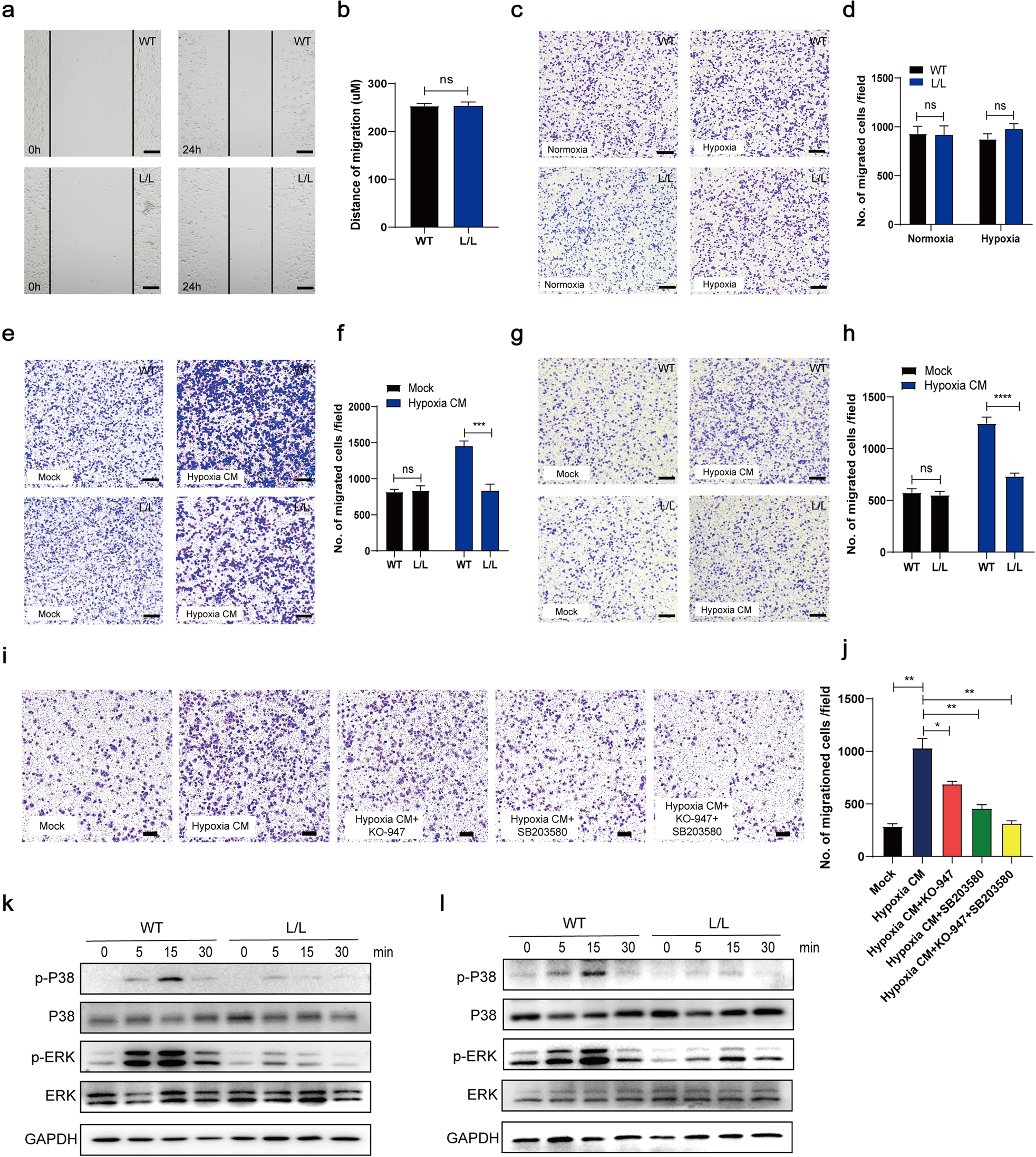 Fig. 5: SET regulates chemotaxis in macrophages through p38 and ERK signaling.