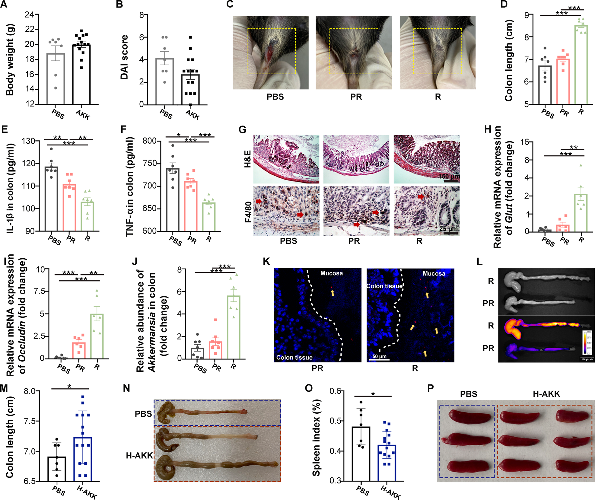 Fig. 1: A. muciniphila colonization correlates with its therapeutic efficacy in DSS-induced colitis.