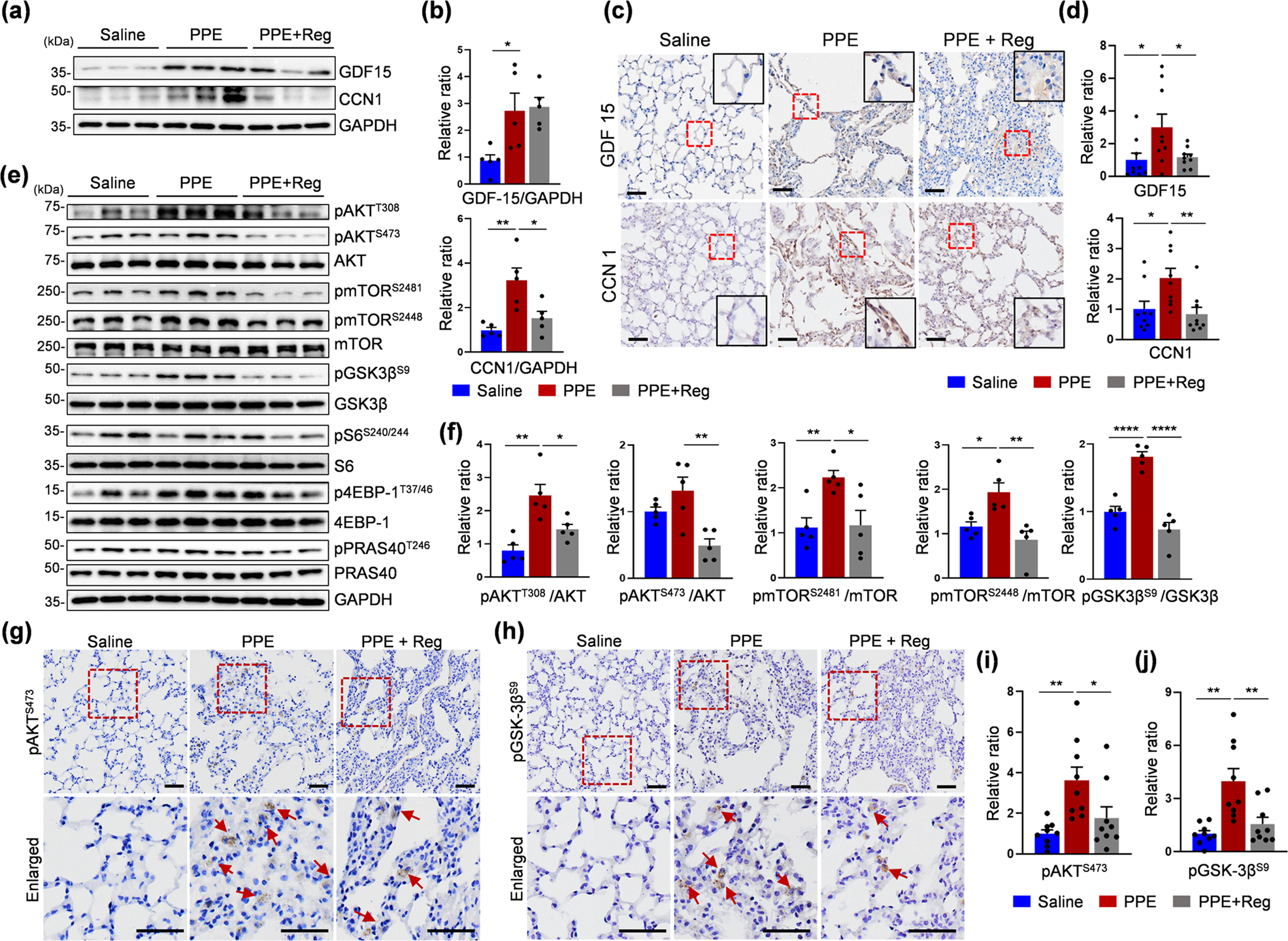 Fig. 6: Alterations in the expression of senescence-associated and AKT/mTOR signaling proteins in response to regorafenib in PPE-treated mice.