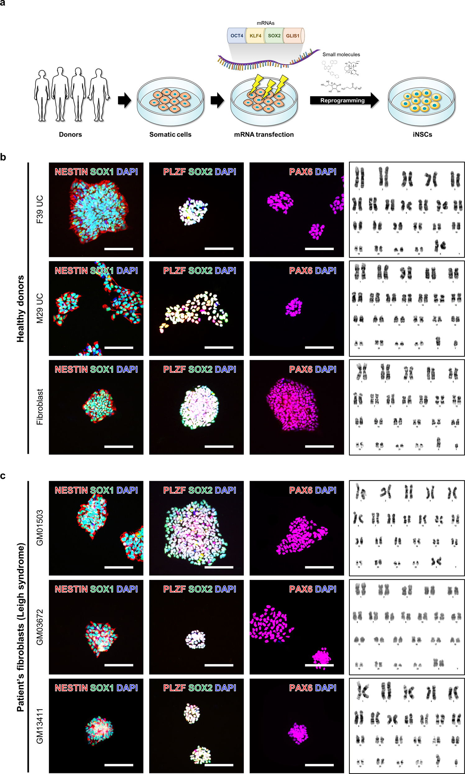 Fig. 1: Direct reprogramming of human somatic cells into induced neural stem cells (iNSCs).