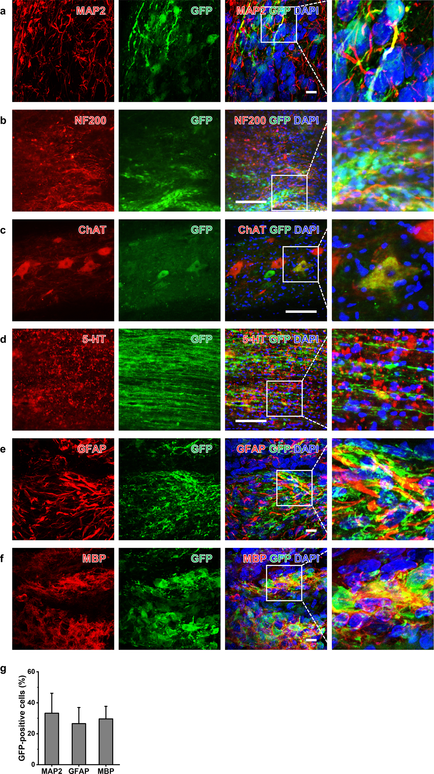 Fig. 4: Differentiation of iNSCs in sites of SCI.