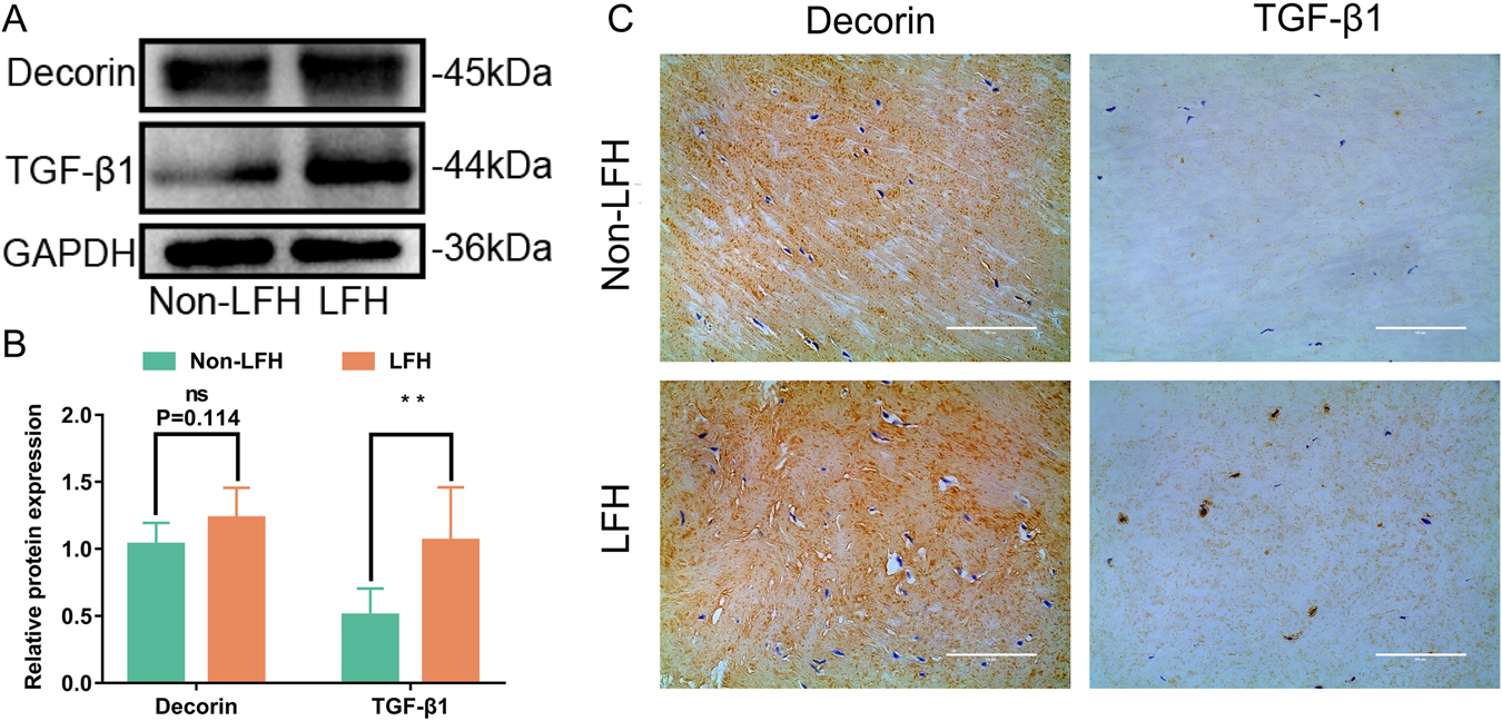 Fig. 3: TGF-β1 and DCN expression were upregulated in LFH.