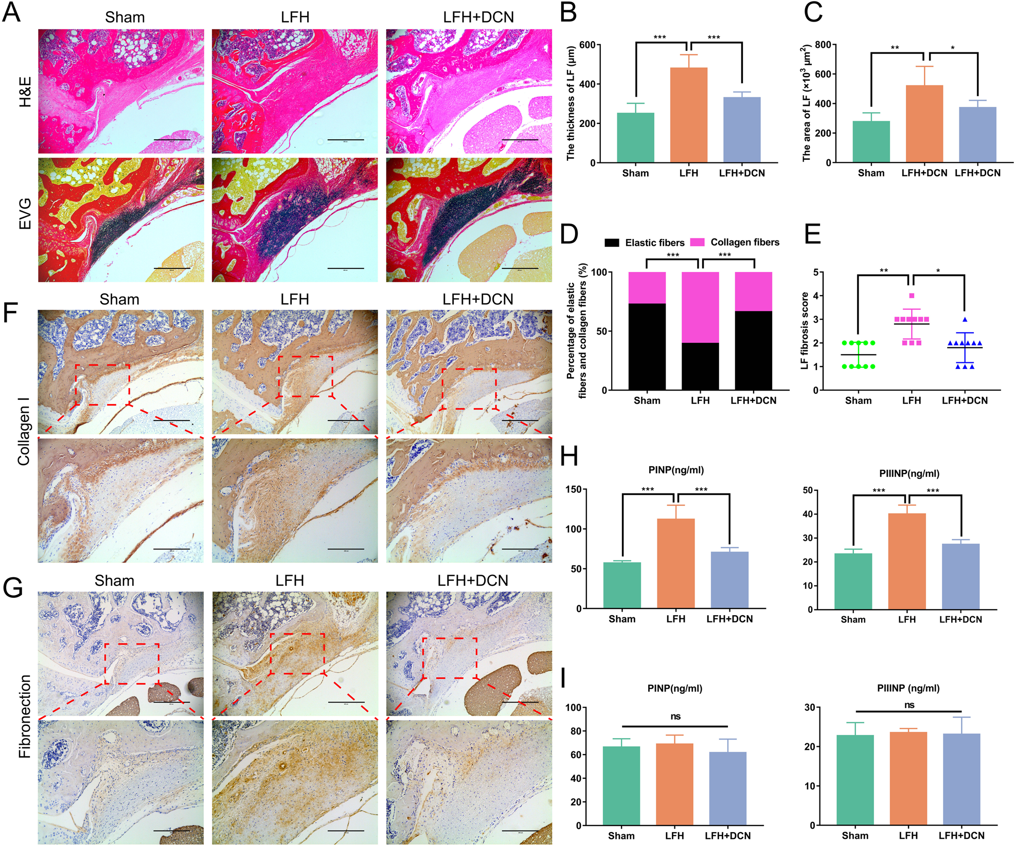 Fig. 7: DCN ameliorates mechanical stress-induced LFH in vivo.