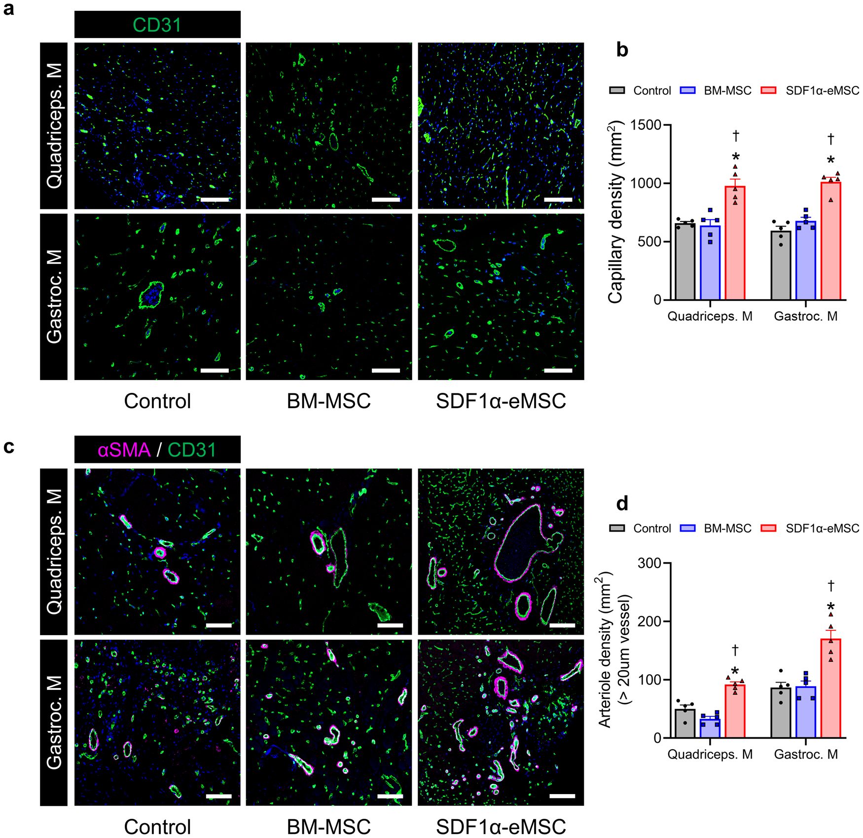 Fig. 4: SDF1α-eMSCs significantly promote angiogenesis at Day 28 following hindlimb ischemia.
