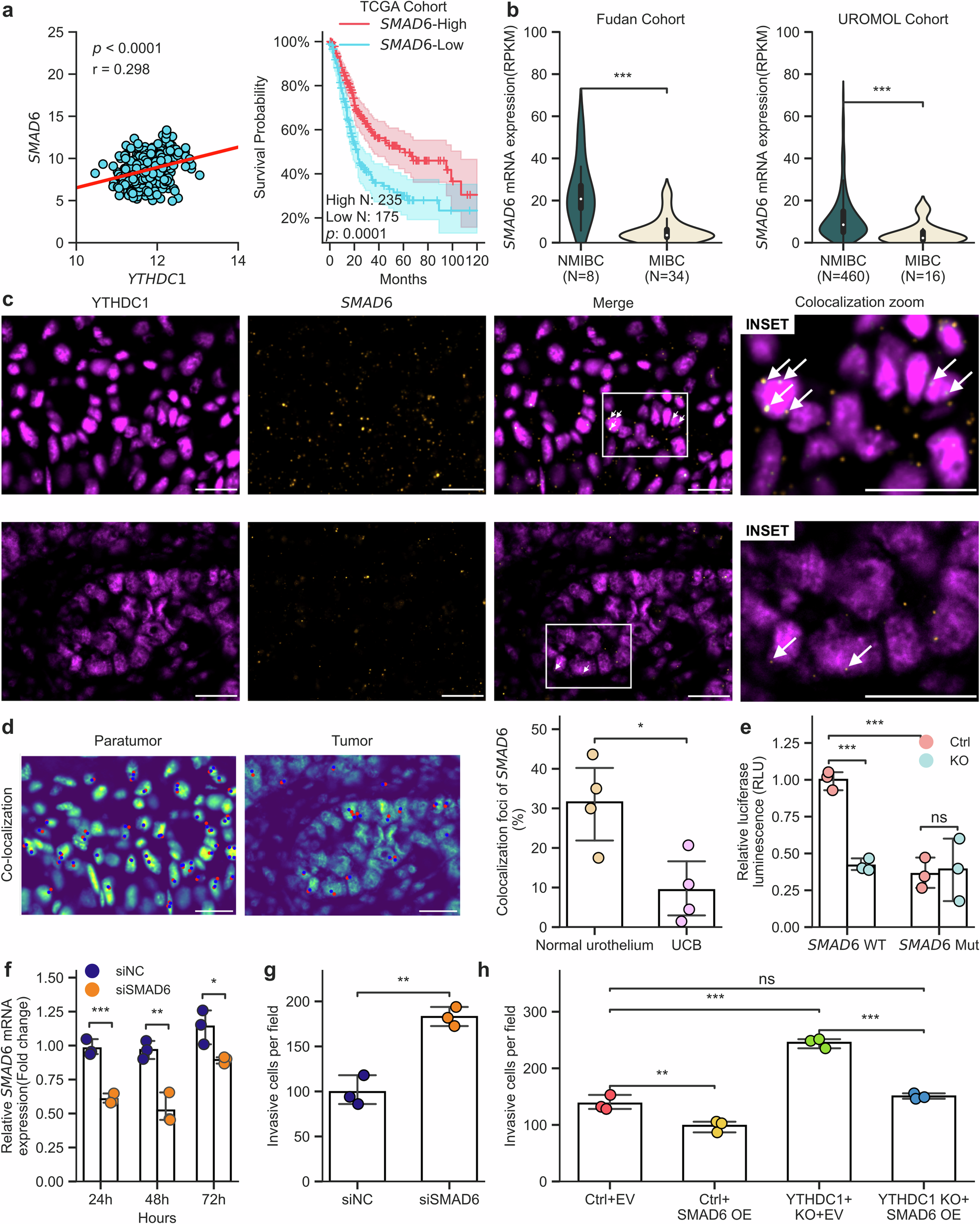 Fig. 6: Dysregulation of YTHDC1-SMAD6 promotes invasion in UCB.