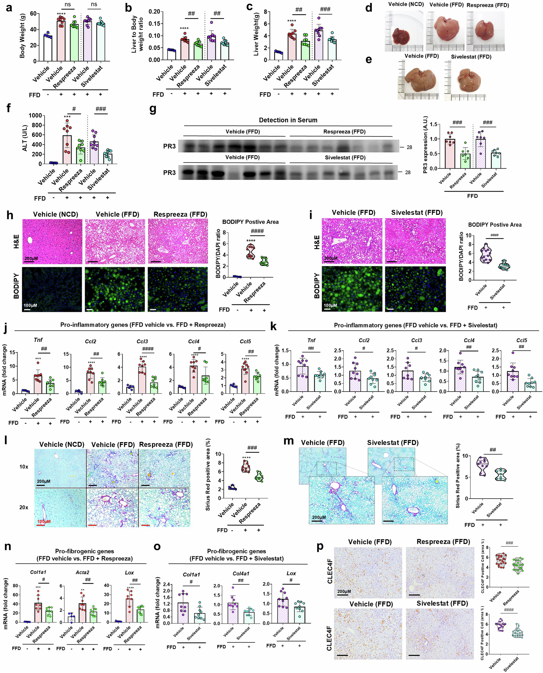 Fig. 3: A1AT supplementation or PR3 inhibition improves steatohepatitis and fibrosis in mice.