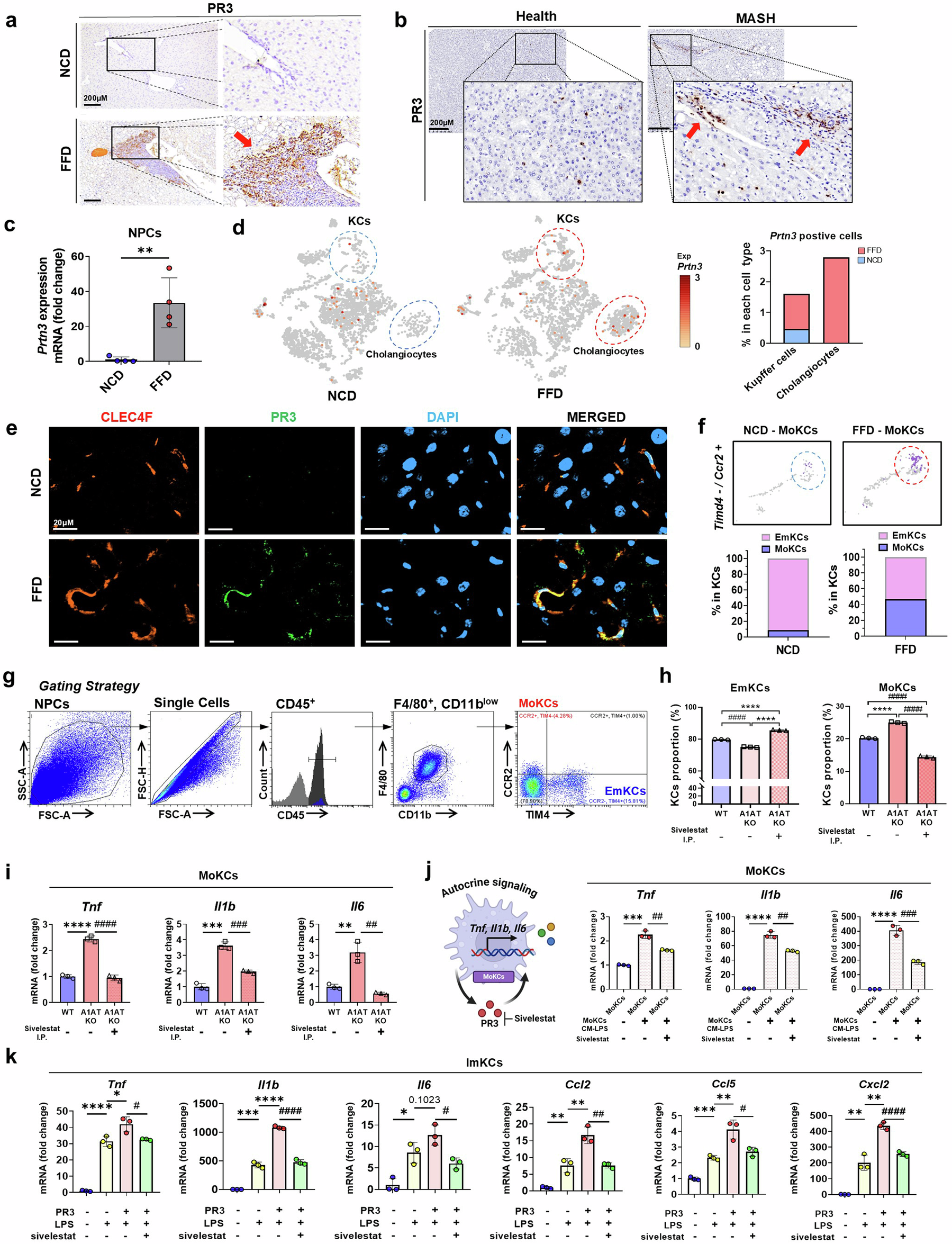 Fig. 5: MoKCs play a crucial role in increasing PR3 levels, leading to hepatic inflammation in MASH.